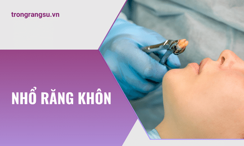 Nhổ răng khôn cần lưu ý những gì ?