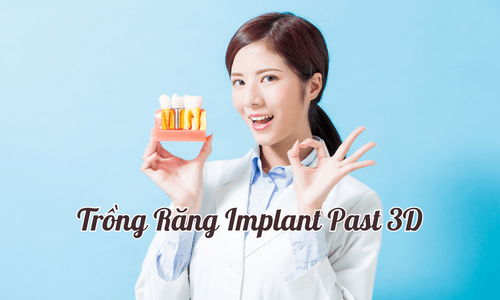 Trường hợp nào thì nên trồng răng Implant Fast 3D?