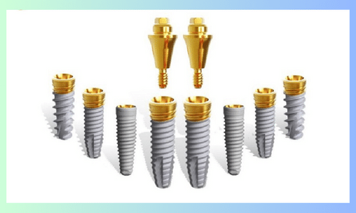 Trụ Implant Mỹ có gì khác biệt?