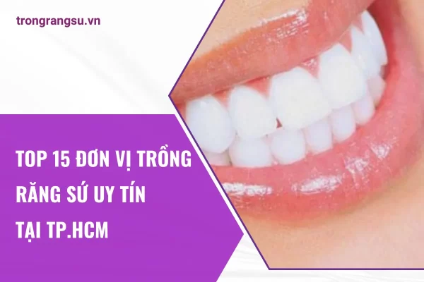 Top 15 đơn vị trồng răng sứ uy tín tại TP.HCM